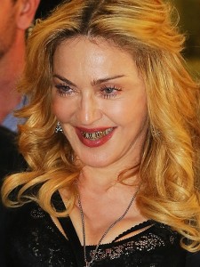 madonna grillz