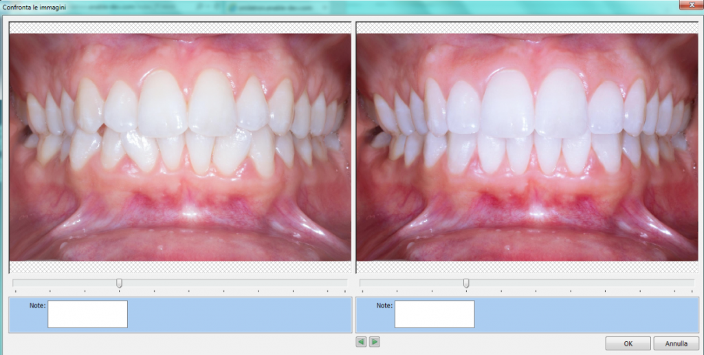 Fotosimulazione Smiletronic