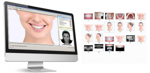 tecnica di analisi estetica del sorriso