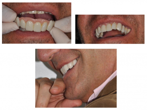 trucco dentale padova treviso
