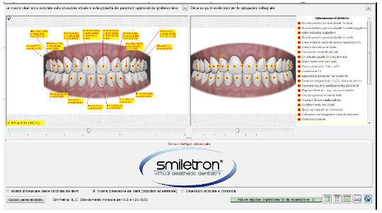 progettazione_di_un_nuovo_sorris