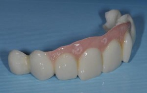 Mock up dentale di scena