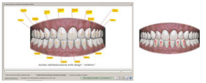 smile analysis