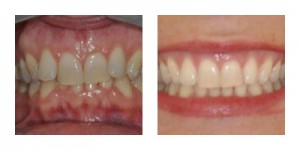 Estetica dentale