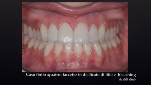 design dentale Padova Treviso