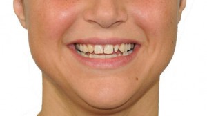 Trattamenti per sorriso esclusivo